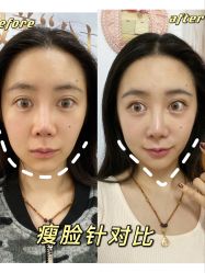 -美莱医疗美容医院