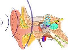 -安湃声助听器(同仁医院店)