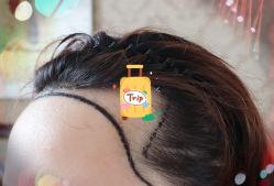 -大麦微针植发全国连锁