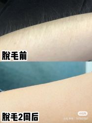-中科妍美专业脱毛美肤连锁机构