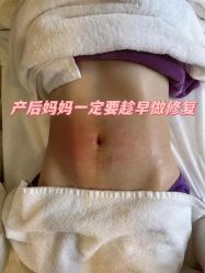 -上海百佳妇产医院