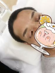 -Doris多里斯半永久纹眉·SMP纹发·发际线