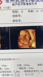 -常州武进妇婴医院