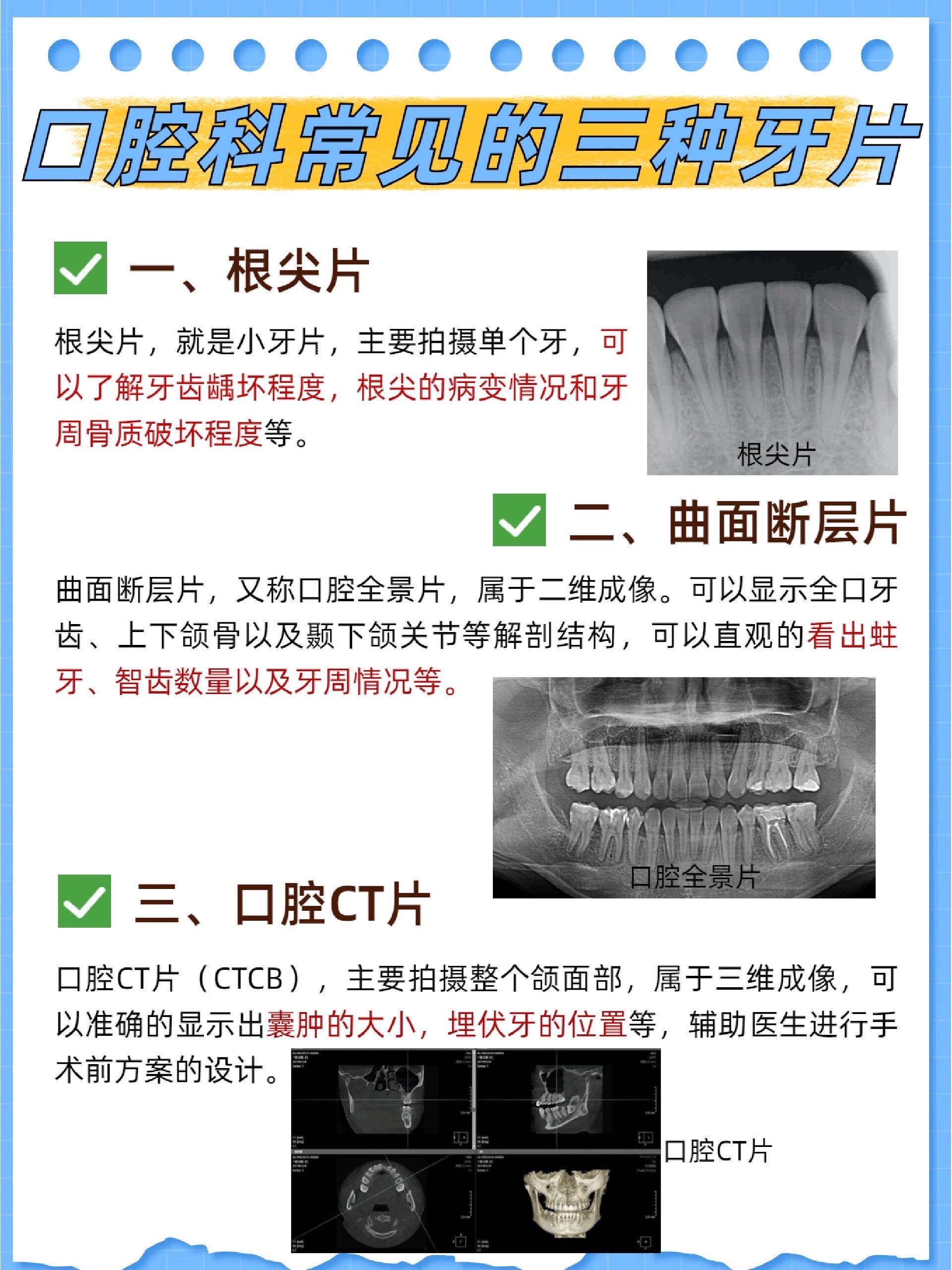 牙齿拍片解析图图片