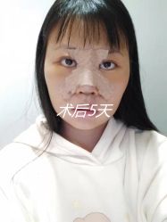 -成都西区医院整形美容