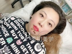 -RC半永久纹眉纹发际线
