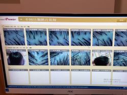 -丝客富脱发养发头皮馆