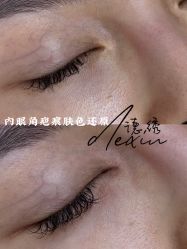 -德绣·机器野生眉发际线·美瞳线半永久