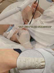 点击看大图 -美肤盾祛痘·问题肌头疗管理中心