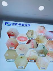 -资医堂·除疤祛痘祛斑