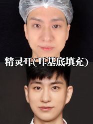 体验前-深圳美莱医疗美容医院