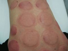 -太乙盲人推拿按摩连锁(星洲店)