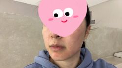 体验后-BR光电保养