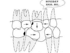 -团圆口腔·种植中心(锦江院区)