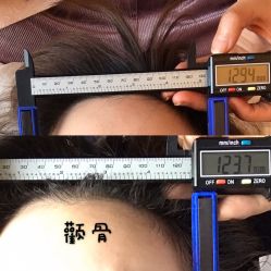 -颜和骨正·明哲式骨相美学整骨