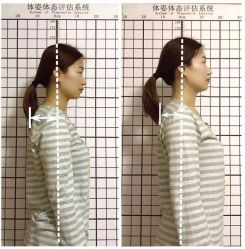 -FACE·日本小颜矫正美容整骨サロン