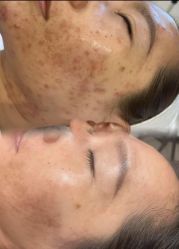 点击看大图 -智丽佳人祛斑祛痘美容美体