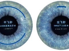 -阿玛施眼科