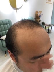 -发饰美男士增发补发假发定制店