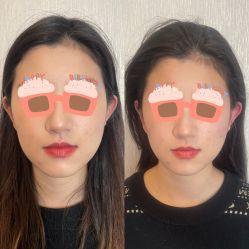 -小林日式·小颜整骨院