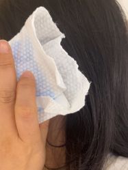 体验后-广东韩妃整形外科医院