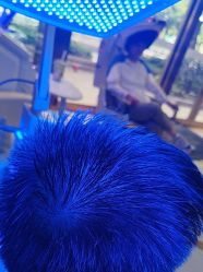 -碧莲盛·不剃发植发