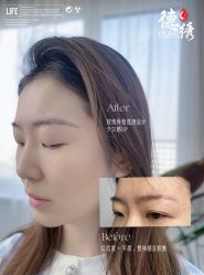 -德绣·机器野生眉发际线·美瞳线半永久