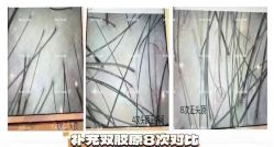 -丝域养发馆