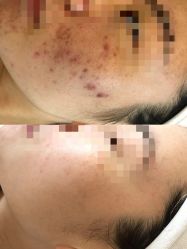 -康美贞·痘肌养护管理中心