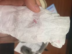 点击看大图 -新肤洗纹身