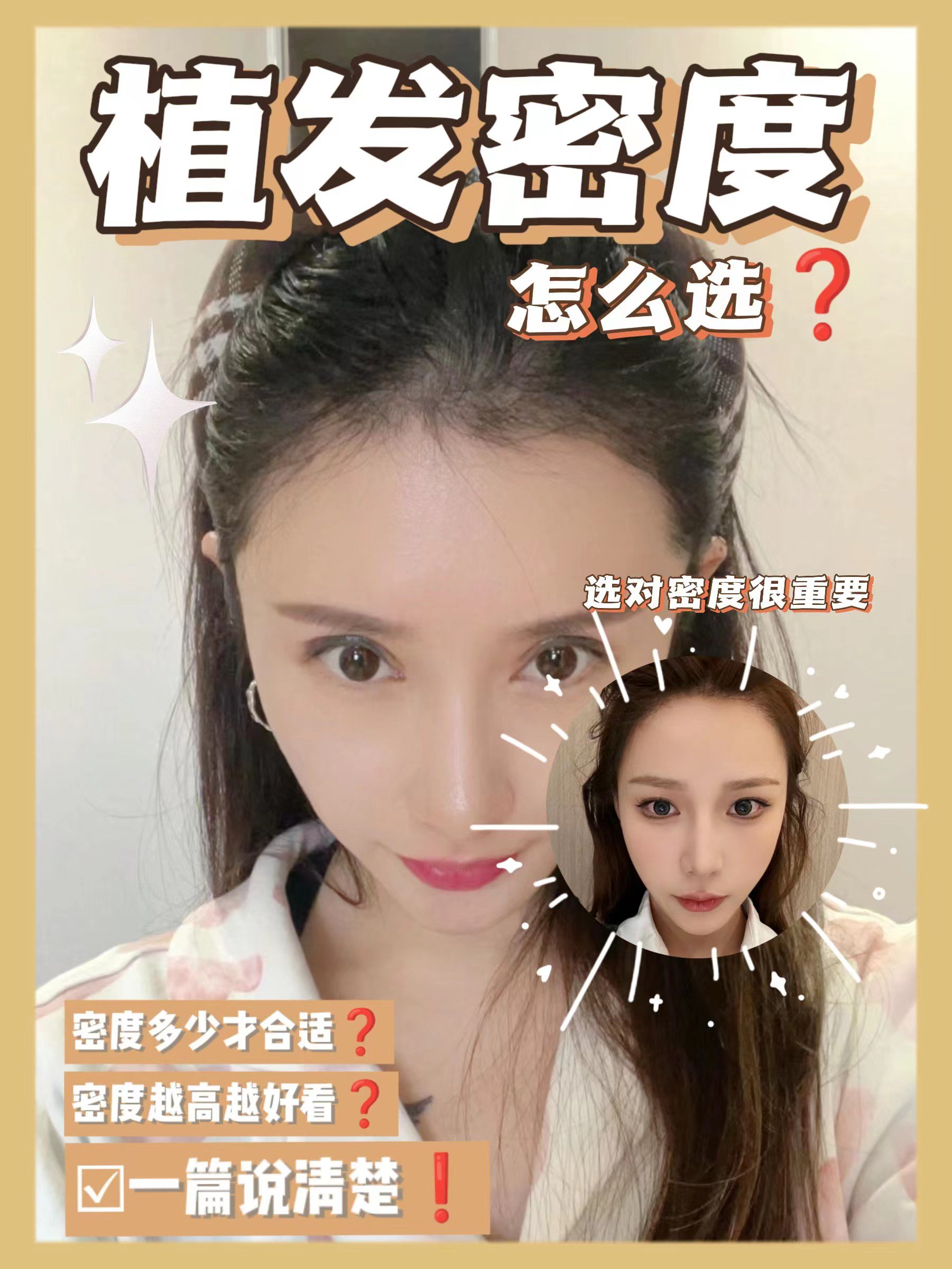 为什么要去植发(为什么有些人要植发)