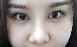 体验后-上海锦妍医疗美容门诊部