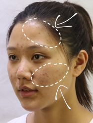 -广州美莱医疗美容医院