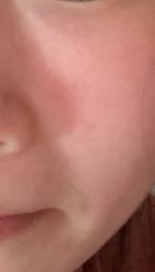 体验前-BR光电保养