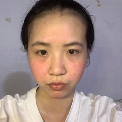 体验前-广东韩妃整形外科医院