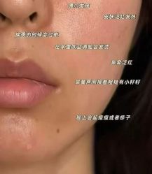 点击看大图 -MLP美丽派·问题肌疗愈中心