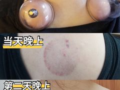 -冬日中医馆(枋湖店)