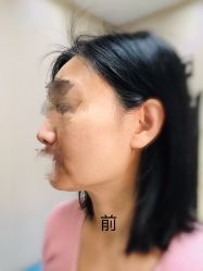 体验前-小忠丽格医美