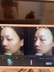-苑苑vbeauty科技美容SPA
