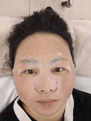 体验前-深圳春天阳光医院·轮廓抗衰中心