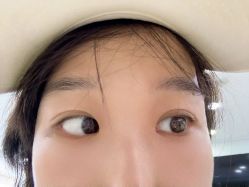 -天津健丽·去眼袋医疗美容机构