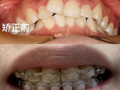 -同步齿科·数字化正畸种植口腔中心(珠海店)