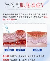 点击看大图 -玛莲朵·海菲秀冰珀科