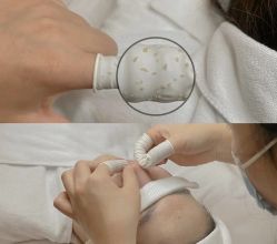 -美肤盾祛痘·问题肌头疗管理中心