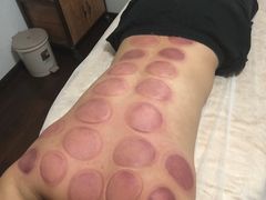 -张钰强中医正骨推拿连锁(华发商都店)