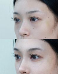 -Yestar艺星医疗美容医院