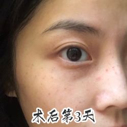 -铂诗玥医美