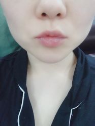 体验前-上海锦妍医疗美容门诊部