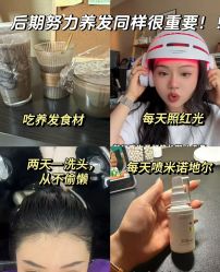 -碧莲盛·不剃发植发