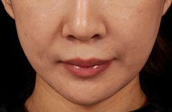 -Dr.U博士医疗美容医院